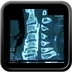 Maladie des japonais du rachis cervical TDM RACHIS CERVICAL