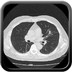 Atteinte pulmonaire active d'une granulomatose de Wegener  TDM Thorax Axial Fenêtre Air