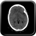 Abdominal vessels trauma, Intraperitoneal bladder rupture, Spleen infarction, Pelvic fracture Head CT, Axial plane, Soft tissue window Abdominal vessels trauma, Intraperitoneal bladder rupture, Spleen infarction, Pelvic fracture Head CT, Axial plane, Soft tissue window