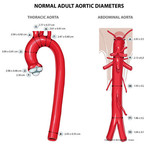 Anatomy of the aorta normal-adult-aortic-diameters-en Anatomy of the aorta normal-adult-aortic-diameters-en