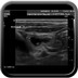 Purpura rhumatoïde échographie digestive