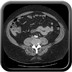 Diverticulite sigmoïdienne  TDM Abdomen Pelvis Axial Portal