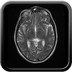 Histiocytose X langerhansienne thoracique et cérébrale  IRM Crâne Axial T2