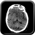 perforation digestive, éventration, fracture-dislocation du rachis lombaire crane axial mou