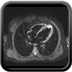 Micro-infarctus cardiaques multiples sur syndrome des anti-phospholipides T2 DB SPIR
