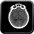 traumatisme cranien, dissection carotidienne, perforation digestive, traumatisme artère pulmonaire, fracture de Chance crane axial mou