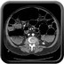 Occlusion mécanique colique sur sténose inflammatoire pseudo-tumorale secondaire à une diverticulite du sigmoïde Axial