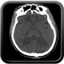 traumatisme thoracique, hématome sous capsulaire hépatique, traumatisme du bassin. crane axial