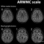 ARWMC scale ARWMC-Scale ARWMC scale ARWMC-Scale