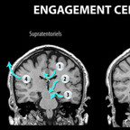 Anatomie du cerveau engagements-cérébraux Anatomie du cerveau engagements-cérébraux