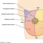 Cancer du sein Quadrants du sein et cotation CIM-10 Cancer du sein Quadrants du sein et cotation CIM-10