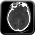 traumatisme cranien, fracture du massif facial, traumatisme thoracique, fracture pelvienne, traumatisme spléno-rénal crane axial mou