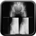 Chondrosarcome sur exostose ostéogénique  Radiographie Pelvis