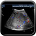 Néphroblastome droit Echographie abdo