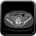 Veine rénale gauche circumaortique  TDM Abdomen Axial Temps veineux
