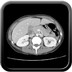 Tuberculose multiviscérale avec atteinte ganglionnaire, pleurale et hépatosplénique  TDM Abdomen Axial Fenêtre Tissus mous