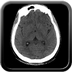 Renal vein rupture, Adrenal hemorrhage Head CT, Axial plane,  Soft tissue window