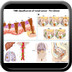Colorectal cancer staging TNM-rectum-cancer-staging