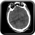 Cranioencephalic injuries, limb injuries, aspiration pneumonia Head CT, Axial plane, Soft tissue window