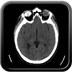 traumatisme thoracique, fracture-dislocation de L5, hernie discale post traumatique. crane axial mou