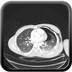 Pneumothorax et contusion pulmonaire post traumatiques avec emphysème sous cutané et médiastinal Axial poumons