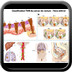 Cancer colorectal - Staging TNM du cancer du rectum classification