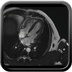 IDM antéro-septo-apical, non viable sans thrombus intracavitaire résiduel CINE TRUFI 4C