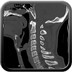 Entorse grave du rachis cervical Sagittales fenêtre osseuse