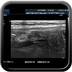 Appendicite aigüe médicale (catarrhale) ECHO TD