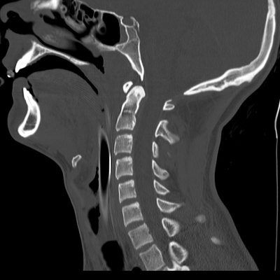 Cranioencephalic trauma, Facial fracture, Thoracic injuries, Pelvic fracture, Spleen and renal trauma Cervical spine, Sagittal plane, Bone window