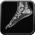 Tendinopathie aiguë achiléenne droite inflammatoire et myoaponévrosite plantaire superficielle T1 Sagittal