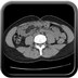 Maladie de Cacchi Ricci  TDM Abdomen Pelvis  Axial Sans injection