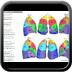 Lung anatomy lung segmentation