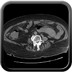 Hématome pariétal jéjunal Axial