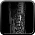 Hernie discale foraminale L5-S1 gauche, Modic 1 Sagittal T2 