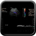 Syndrome du défilé thoraco-brachial artériel gauche. Echographie-Doppler du membre supérieur