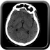 Occipital Condyle Fracture, Thoracic injuries, Hepatic trauma, Adrenal hemorrhage Head CT, Axial plane, Soft tissue window Occipital Condyle Fracture, Thoracic injuries, Hepatic trauma, Adrenal hemorrhage Head CT, Axial plane, Soft tissue window