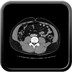 Appendagite caecale Axial