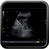 Néoplasie prostatique multimétastatique Echographie vésicale
