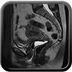Cancer du col utérin étendu sur 20 mm de hauteur et de grand axe transversal avec doute sur une atteinte du paramètre gauche (interruption d'un anneau fibreux péri-cervical) : probable stade II b Sagittal T2