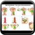 Carcinoma of the endometrium FIGO-Classification-Carcinoma-of-the-endometrium-en