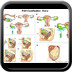 Ovarian cancer FIGO-Classification-Ovary