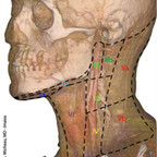 Aires ganglionnaires cervicales Aires ganglionnaires du cou Aires ganglionnaires cervicales Aires ganglionnaires du cou