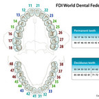 Tooth number FDI-World-Dental-Federation-notation Tooth number FDI-World-Dental-Federation-notation