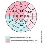 Anatomy of the heart - 17 segments model bull's-eye-display-heart-segmentation- Anatomy of the heart - 17 segments model bull's-eye-display-heart-segmentation-