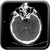 traumatisme cranien, oedème pulmonaire, lacération du rein crane axial mou