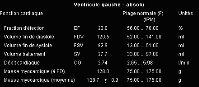 Syndrome de Tako-Tsubo - Myocardite adrénergique Fonction ventriculaire gauche