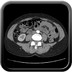 Utérus polyfibromyomateux Artériel