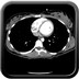 Fracture de Chance de L3 avec dissection post traumatique de l'aorte abdominale. Axial TAP artériel