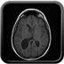 Central neurocytoma  MRI Head Axial T1 FSE